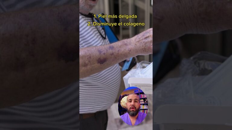 manchas de sangre en la piel de los ancianos