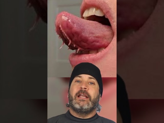 parte inferior de la lengua