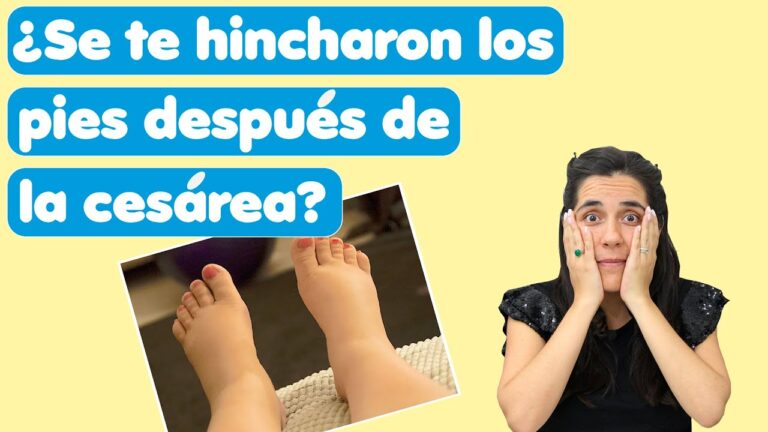 pies hinchados despues del parto por cesarea