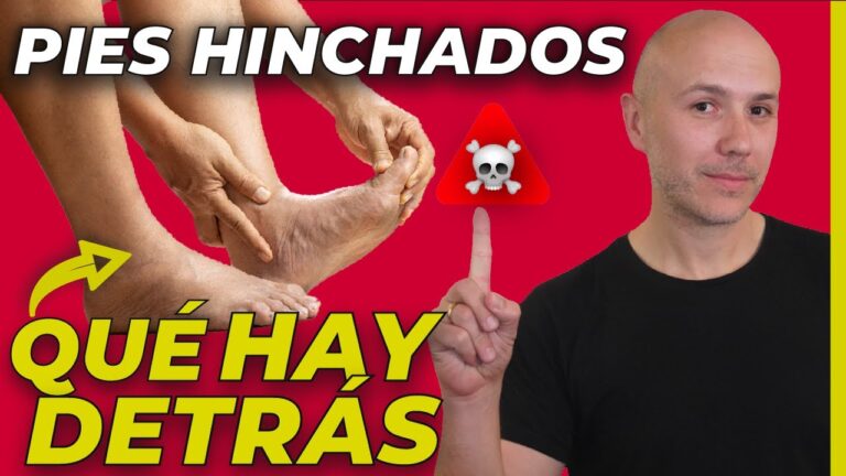 porque se hinchan las venas de los pies