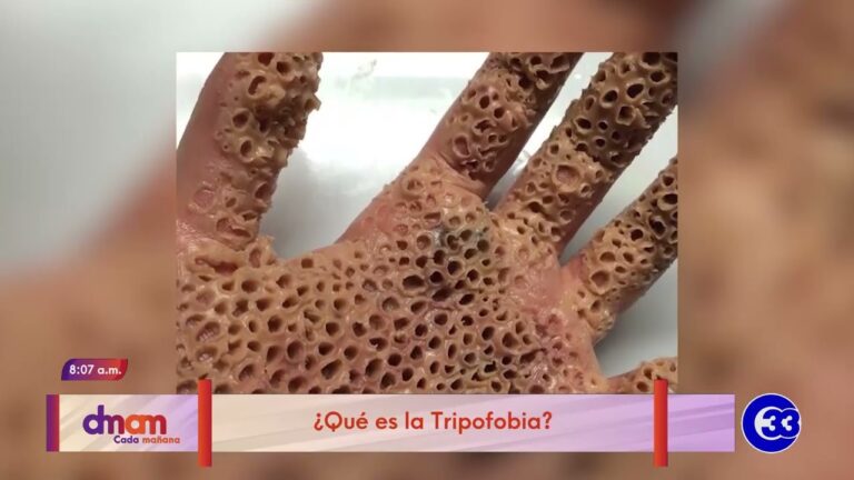 que es la tripofobia en la piel